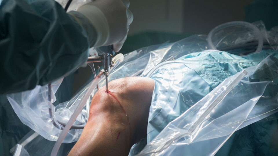 Common Mistakes to Avoid During Surgery Recovery